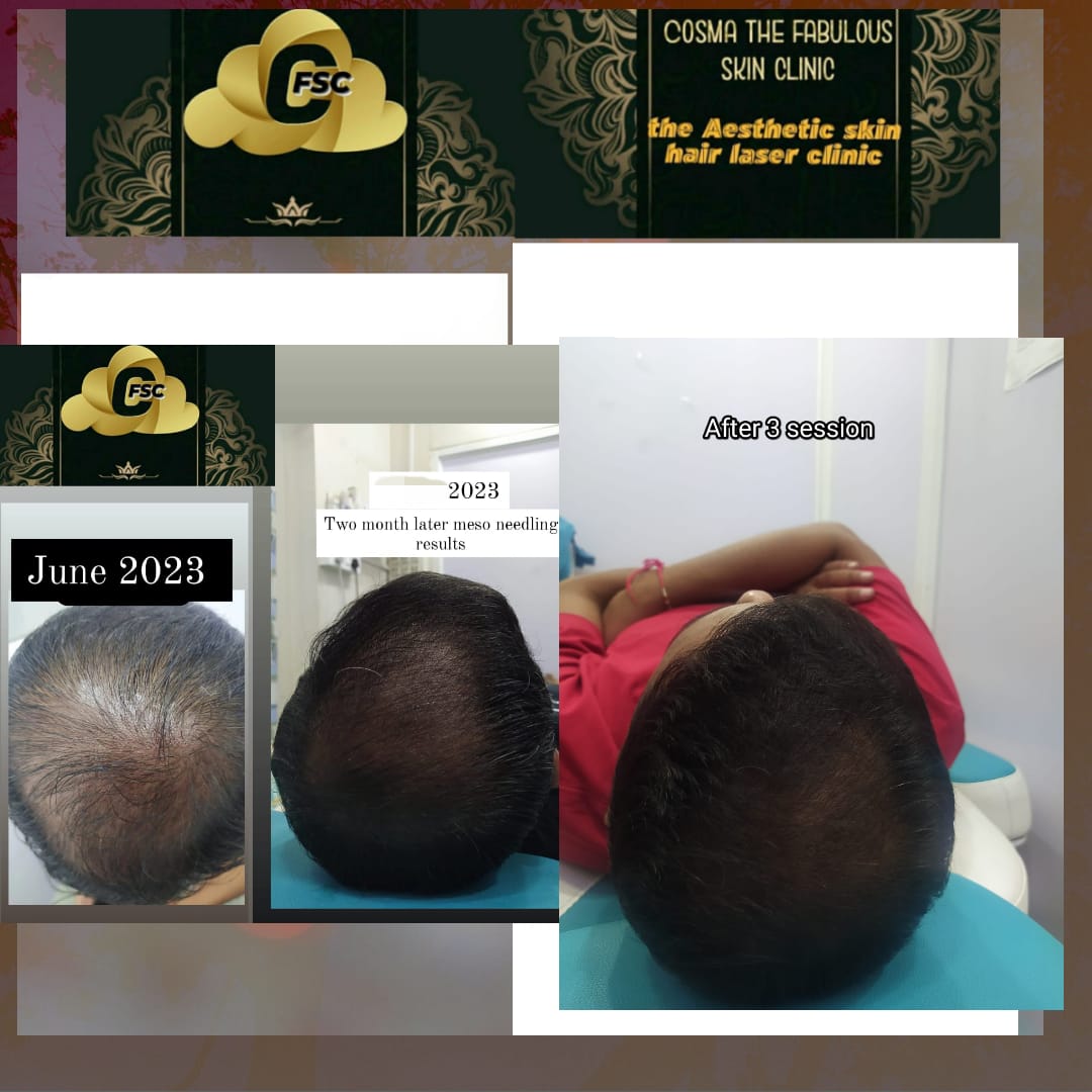 Before After Cosmetic Treatment